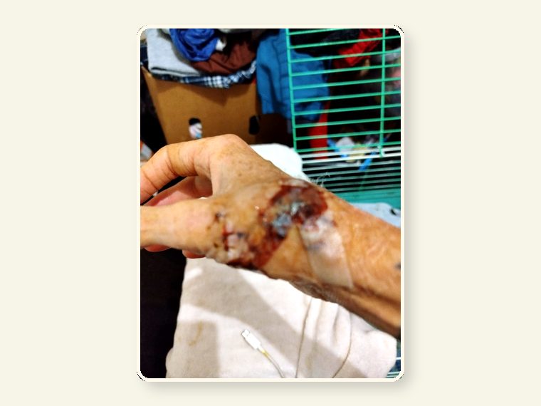 Weeper Byte Hand1 — shown as an educational reminder of the risks, injuries and behavioural realities involved in exotic animal ownership.