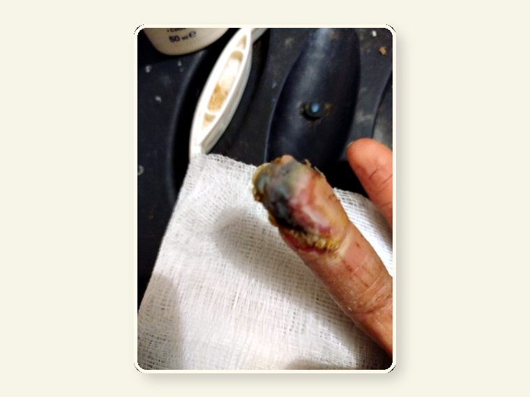 Weeper Finger byte2 — shown as an educational reminder of the risks, injuries and behavioural realities involved in exotic animal ownership.